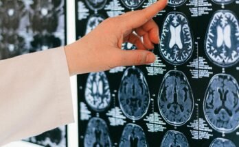 How to Reset Your Dopamine (And Change Your Life)